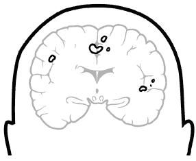 brain frontal view, areas outlined