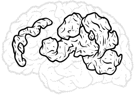 brain with a lot of highlighted areas