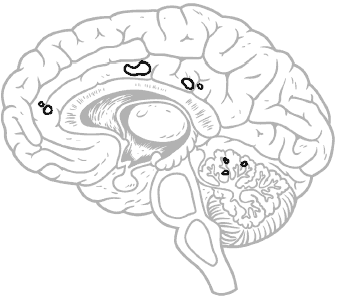 brain side view, areas outlined